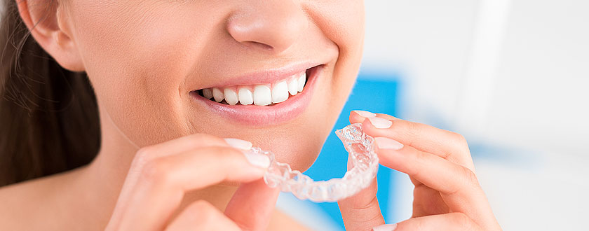 Braces & Aligners