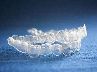 Braces Treatment