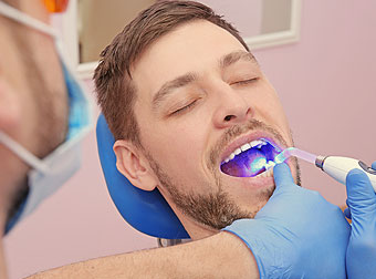Dental Filling Process