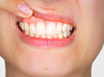 Gum Health Care
